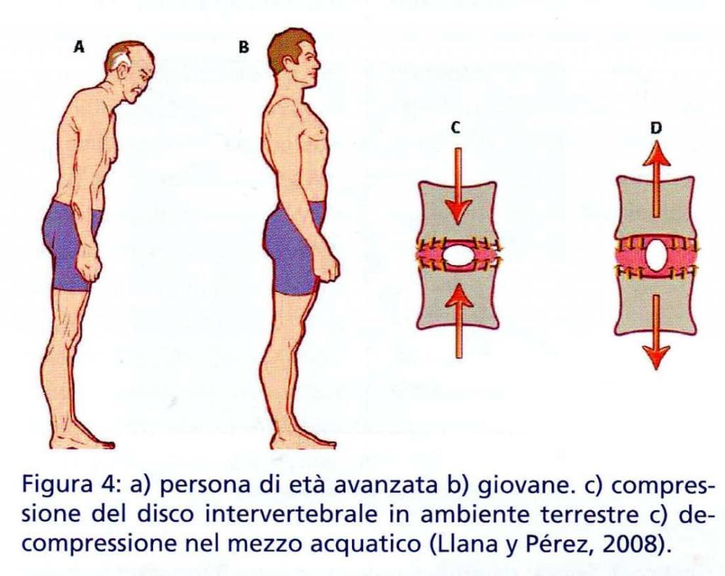 figura 4 compressione vertebre in acqua